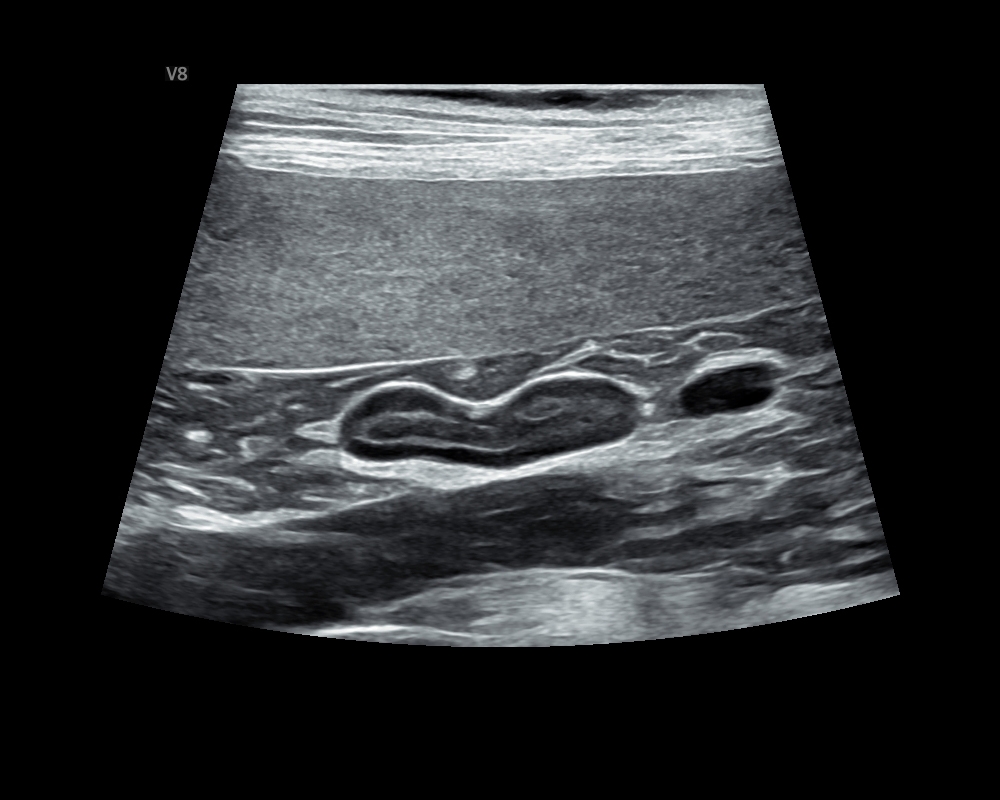 狗 腎上腺 Adrenal gland.JPG