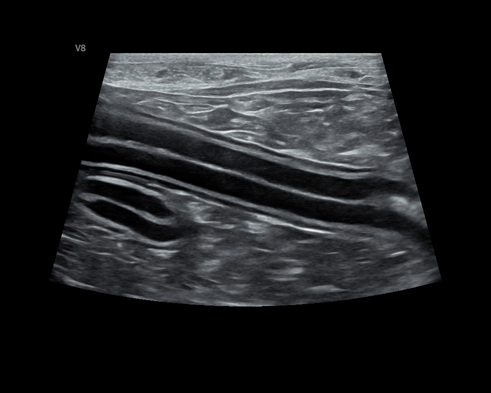 Dog_Intestinal tract 
