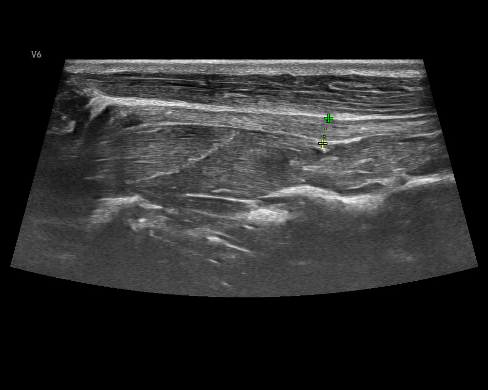 貓 甲狀腺 Cat_Thyroid gland.JPG